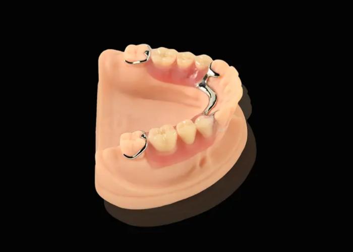 Unveiling the Superiority of Co-Cr Dentures in Restorative Dentistry