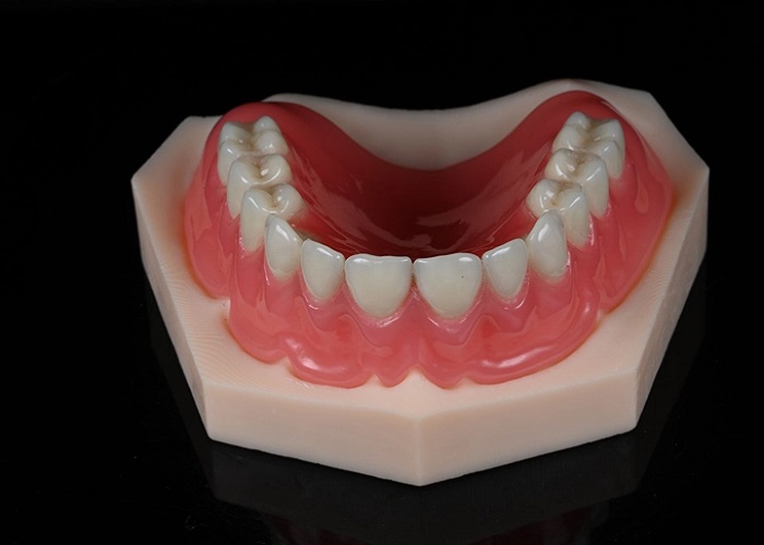 3D Printing Technology of Acrylic Full Dentures in the Digital Revolution