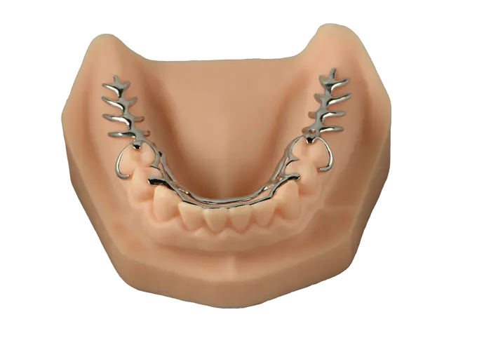 cast frame partial denture