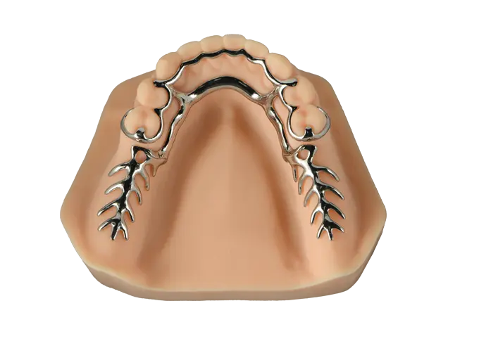 metal frame partial denture