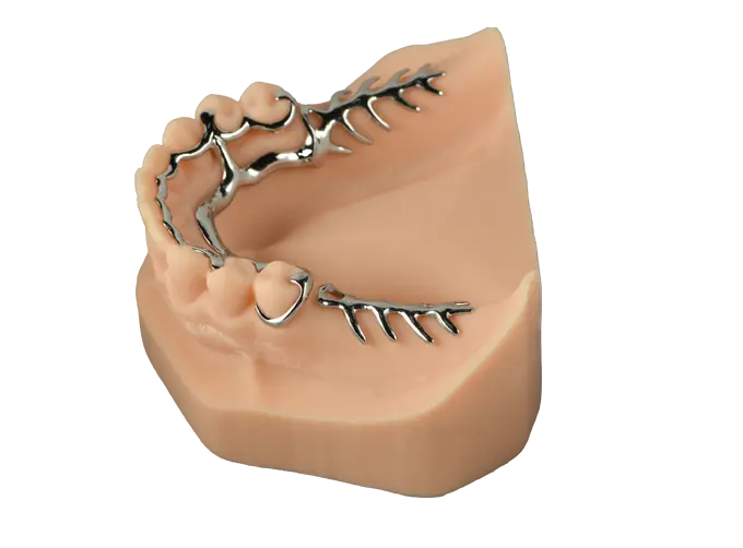 metal partial dentures for front teeth