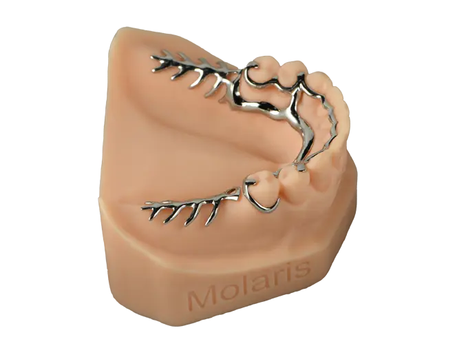 metal partial dentures