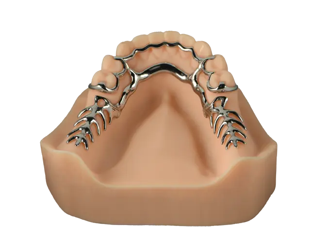 metal partial upper denture