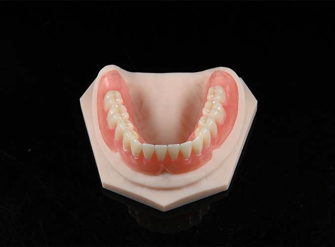 valplast full upper denture