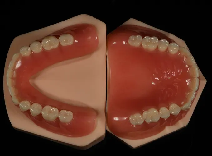 acrylic complete denture