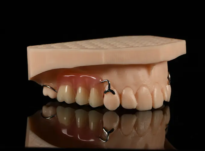 acrylic removable partial denture