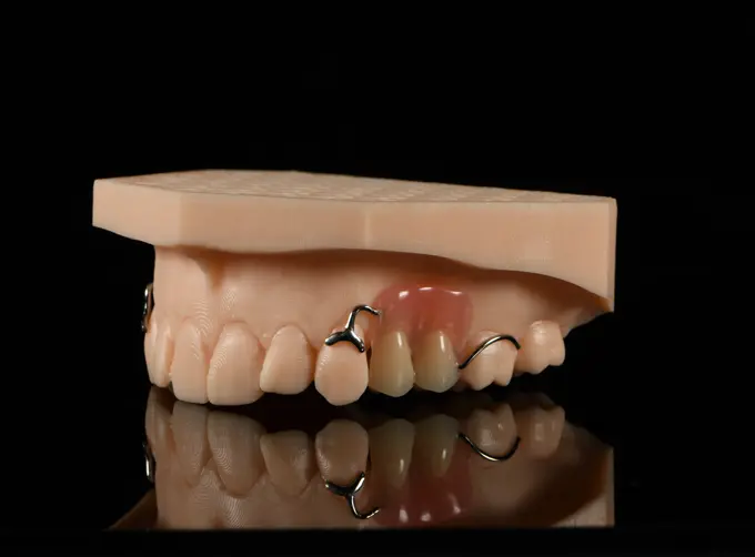 acrylic partial denture with clasps