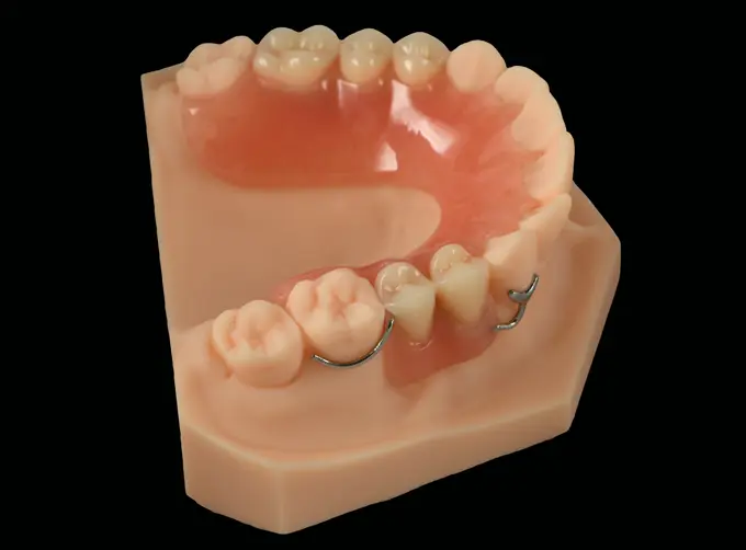 acrylic dental partials