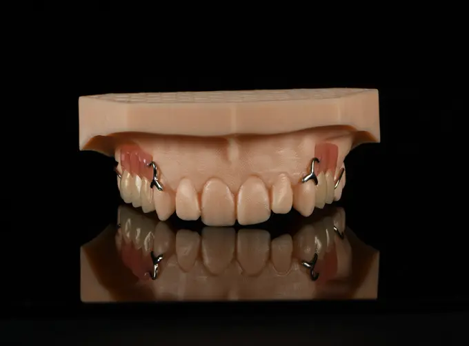 acrylic denture with clasps