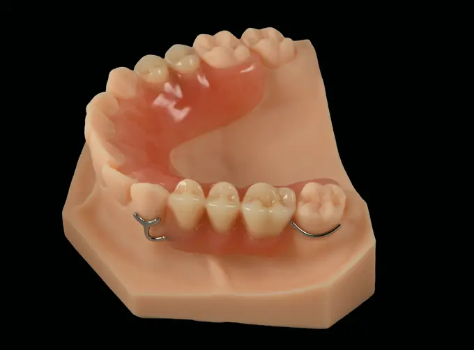 acrylic partial denture cost