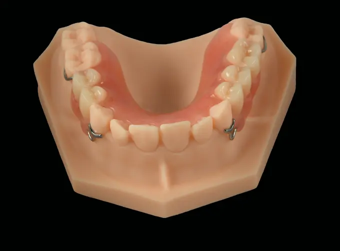 acrylic partial denture price