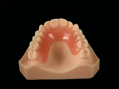 Acrylic Partial Denture (Y Clasp+Wire Clasp)