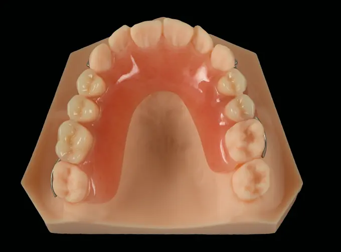 acrylic clasp removable partial dentures