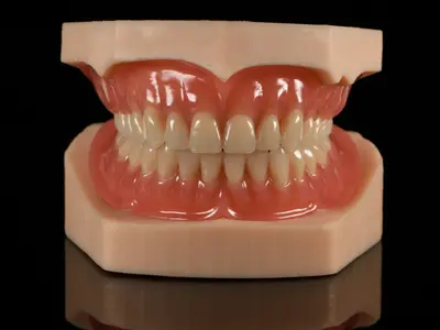 Acrylic Full Denture