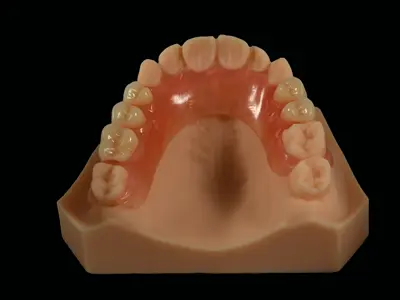 Valplast Partial Denture