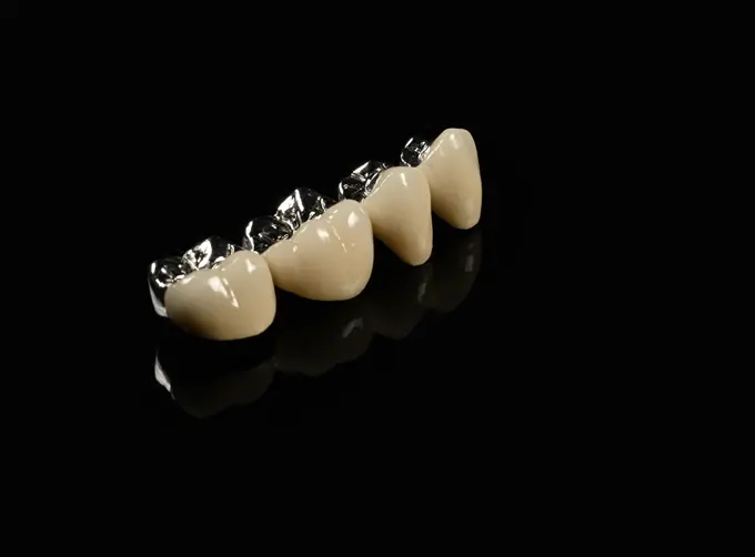 pfm zirconia crowns