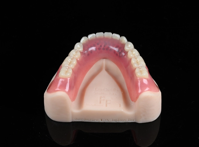 parts of a dental implant system