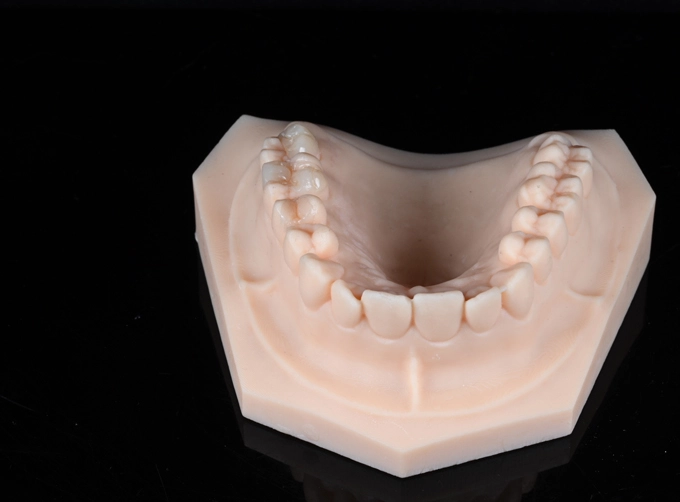 composite inlay dental