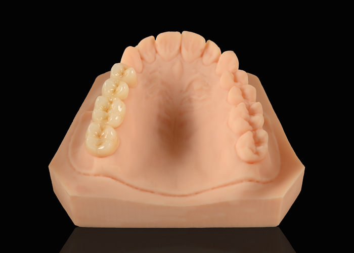 Are Golden Smile Dental Products Safe for People with Sensitive Teeth