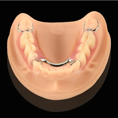 What is a Cast Partial Denture Framework?