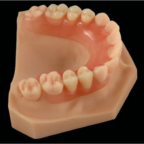 What is Valplast Flexible Denture?